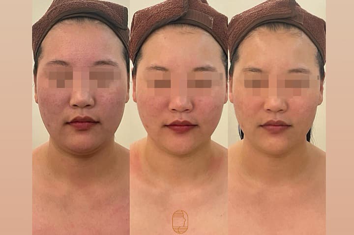 상품 상세 1
