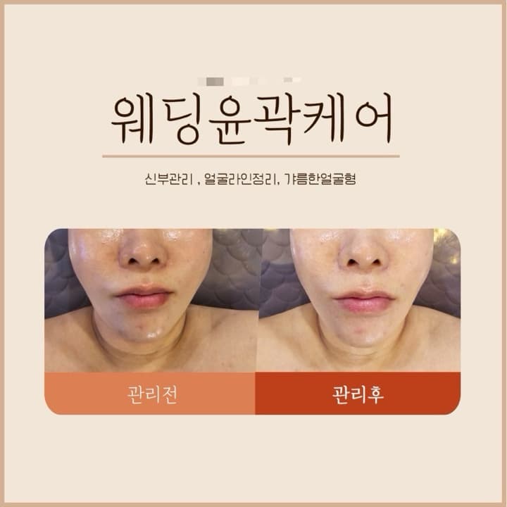 윤곽 관리