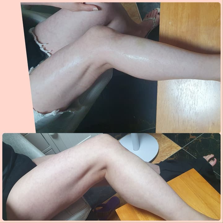 하체관리