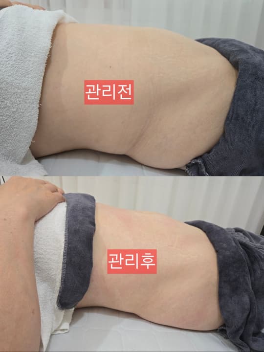 복부관리 