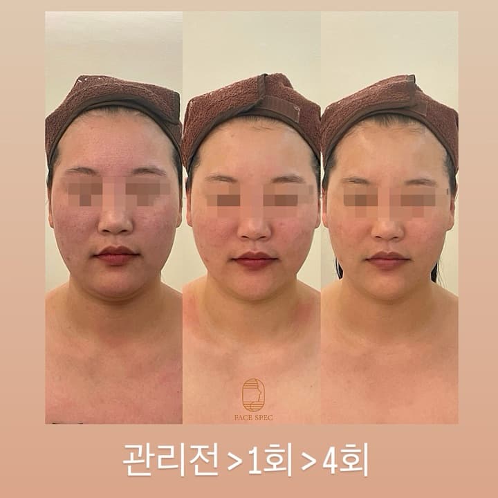 3D윤곽핏 케어